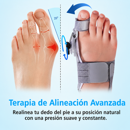La solución para los juanetes Hallux Pro™